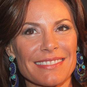 LuAnn de Lesseps Cosmetic Surgery Face