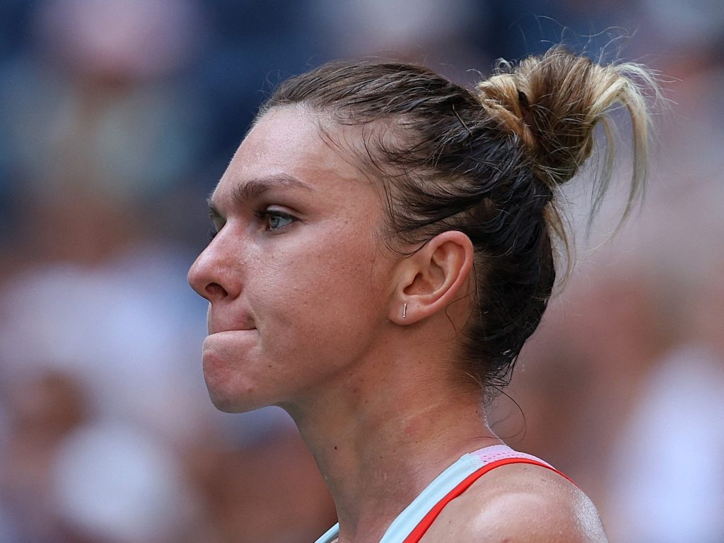 Simona Halep Cosmetic Surgery Face