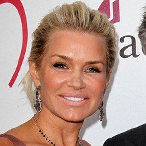 Yolanda Hadid Cosmetic Surgery Face