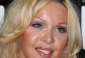Alicia Douvall Plastic Surgery and Body Measurements
