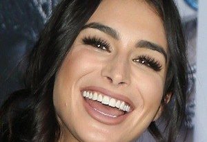 Ashley Iaconetti Plastic Surgery