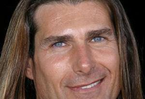 Fabio Plastic Surgery