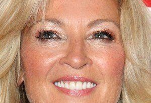 Gillian Taylforth Plastic Surgery and Body Measurements