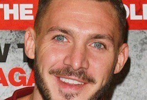 Kirk Norcross Nose Job