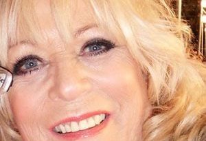 Sherrie Hewson Botox, Facelift, and Fillers