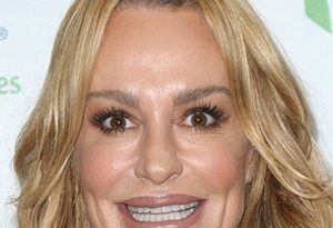 Taylor Armstrong Plastic Surgery Procedures