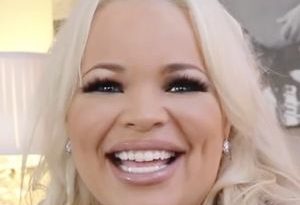 Trisha Paytas Butt Lift, Fillers, and Liposuction